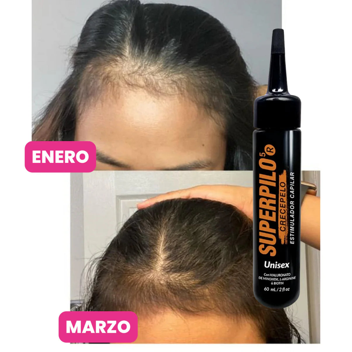 Super pilo Bomba Crecimiento con Minoxidil al 2%