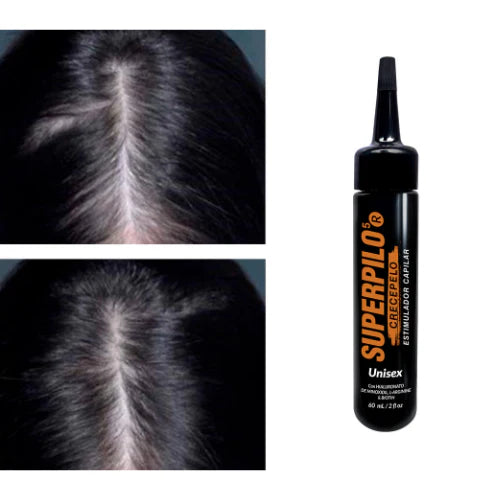 Super pilo Bomba Crecimiento con Minoxidil al 2%